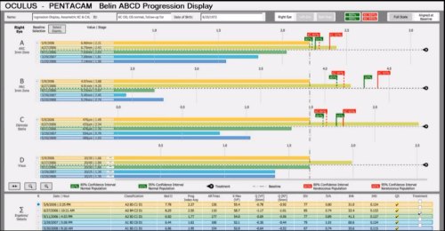 Розроблений на основі протоколів Белліні (ABCD-класифікація) дисплей прогресії дозволяє врахувати всі 4 параметри прогресії кератоконуса та оцінити їх зміни (з урахуванням можливої помилки вимірювання)